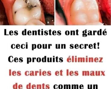 Les dentistes garde ceci secret! Ces produits éliminent les caries et les maux de dents comme un coup de magie…