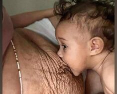 S1. Une femme partage la réalité honnête de son corps après l’accouchement