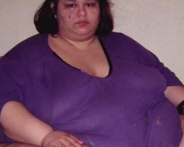 La plus grosse femme du monde a perdu 400 kilos, elle pèse aujourd’hui moins de 90 kg