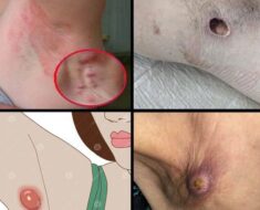 HT10. These are the signs that it’s no longer just sweat… See more