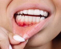 HT10. Don’t Underestimate It: Recognizing the Early Signs of Oral Can…