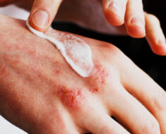 Warning signs you should never ignore on your skin