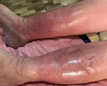 Signs on your feet that could indicate a serious problem