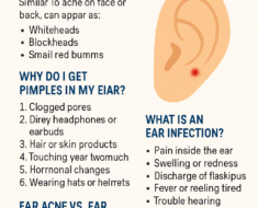 Ear Acne and Ear Infections – What You Need to Know