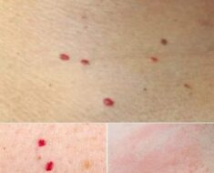 If you spot these red dots on your skin, here Is what they mean!!