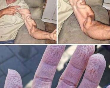 A man goes to stretch and ends up feeling a sharp pain in his arm, it was a ca…