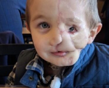 Ryder, 5, survives attack by two dogs only to be called a monster in public