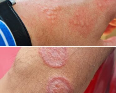 These are the consequences of sleeping with, See more!?