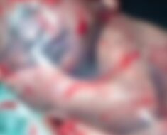 The Baby Who Defied Birth Control, A Viral Story of Fate and Surprise