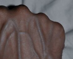 Why Are My Veins So Visible? A Complete Guide to Understanding Prominent Hand Veins!