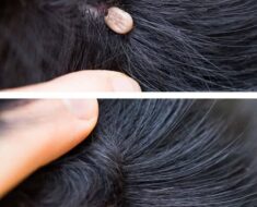 Strange Finding in My Childs Hair, Should We See a Doctor?