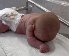 Wow – Baby born with an DIU peg! See more