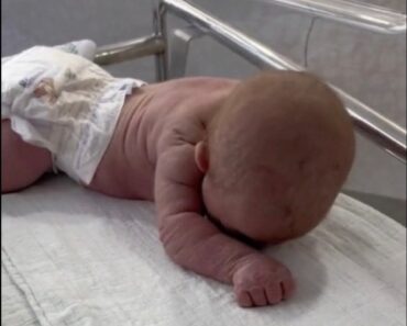 Wow – Baby born with an DIU peg! See more