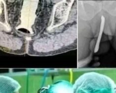 Breaking – Girl had to be hospitalized for wanting to use a pe! See more