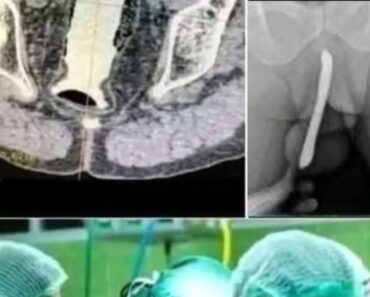 Breaking – Girl had to be hospitalized for wanting to use a pe! See more