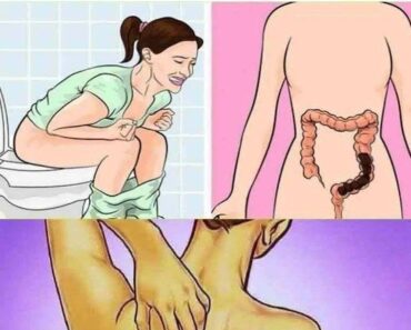 20 subtle cancer symptoms commonly missed!