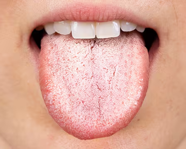 How Your Mouth Health Affects Your Entire Body More Than You Think