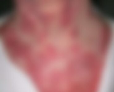 Urgency – These are the consequences of sleeping co! See more – SOTD!