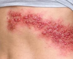 NOW! These are the consequences of sleeping with your c! See more