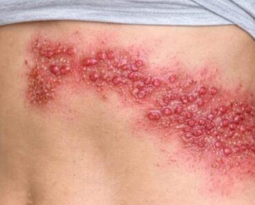 NOW! These are the consequences of sleeping with your c! See more