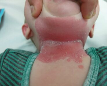 SOTD – These are the signs that he is cr! – See more!