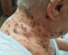 This is the silent disease that is triggered when you come into contact with! See now