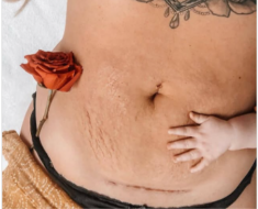 Healthy Moms Get Honest About Post-Baby Bodies — And Fans Are Cheering