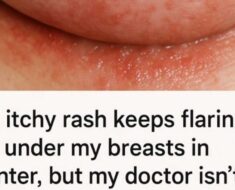 Itchy Rashes Under Your Breasts? How to Treat Them This Winter