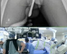 H12. Girl had to be hospitalized for wanting to use a pe…See more