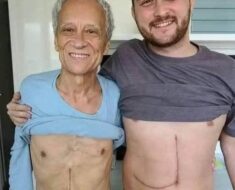 Understanding the Risks and Rewards of Living Liver Donation