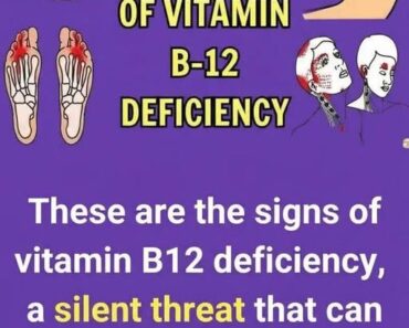 Common Signs and Symptoms of Vitamin B12 Deficiency!